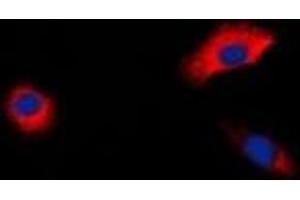 Immunofluorescent analysis of Beta-1 Adrenergic Receptor staining in HepG2 cells.