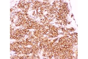 Immunohistochemistry (IHC) image for anti-CD40 (CD40) (AA 1-360) antibody (ABIN3030398)