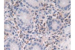 Detection of TGFb2 in Human Stomach Tissue using Polyclonal Antibody to Transforming Growth Factor Beta 2 (TGFb2) (TGFB2 抗体  (AA 303-414))