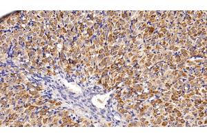 Detection of AST2 in Rat Ovary Tissue using Polyclonal Antibody to Aspartate Aminotransferase 2 (AST2) (AST2 (AA 30-430) 抗体)