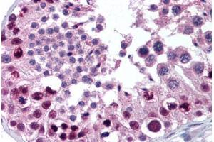 Human Testis (formalin-fixed, paraffin-embedded) stained with MTA2 antibody ABIN301765 at 10 ug/ml followed by biotinylated goat anti-rabbit IgG secondary antibody ABIN481713, alkaline phosphatase-streptavidin and chromogen. (MTA2 抗体  (AA 650-700))