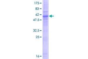 Emerin Protein (EMD) (AA 1-254) (GST tag)