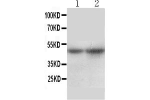 Western Blotting (WB) image for anti-Solute Carrier Family 10 (Sodium/bile Acid Cotransporter Family), Member 1 (SLC10A1) (AA 141-154), (Middle Region) antibody (ABIN3044254)