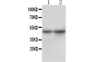 Anti-SLC10A1 antibody, Western blottingAll lanes: Anti SLC10A1  at 0. (SLC10A1 抗体  (Middle Region))
