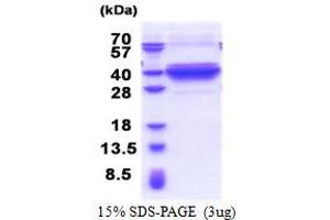 SDS-PAGE (SDS) image for Dynein, Axonemal, Light Intermediate Chain 1 (DNALI1) (AA 1-280) protein (His tag) (ABIN5853347) (DNALI1 Protein (AA 1-280) (His tag))