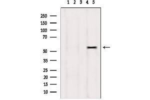 Western blot analysis of extracts from hepg2, using DPP4 antibody.