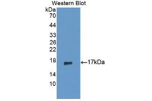 Western blot analysis of the recombinant protein. (PIP 抗体  (AA 41-139))