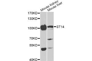 Western blot analysis of extracts of various cell lines, using ST14 antibody (ABIN6293606) at 1:1000 dilution. (ST14 抗体)