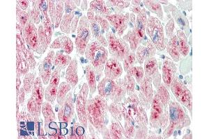 ABIN184953 (10µg/ml) staining of paraffin embedded Human Heart. (TRIM55 抗体  (C-Term))