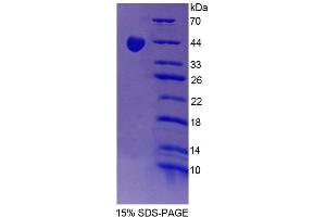 SDS-PAGE analysis of Rat PPP1R15A Protein. (Protein phosphatase 1 (Regulatory Subunit 15A) 蛋白)