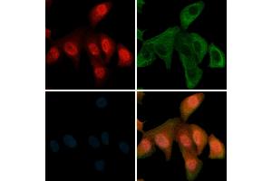 ABIN6256411 and ABIN6267503 staining  cells(H2O2 treatment) by IF/ICC.