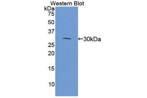 Western Blotting (WB) image for anti-Microtubule-Associated Protein 4 (MAP4) (AA 2-250) antibody (ABIN3206867) (MAP4 抗体  (AA 2-250))