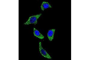 Confocal immunofluorescent analysis of TNFRSF1A Antibody (N-term) (ABIN655208 and ABIN2844822) with U-251MG cell followed by Alexa Fluor 488-conjugated goat anti-rabbit lgG (green). (TNFRSF1A 抗体  (N-Term))