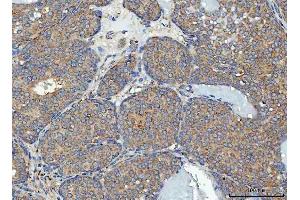 IHC analysis of RPL32 using anti-RPL32 antibody (ABIN7602916). (RPL32 抗体  (C-Term))