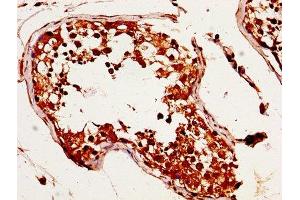 IHC image of ABIN7159296 diluted at 1:320 and staining in paraffin-embedded human testis tissue performed on a Leica BondTM system. (MAGED2 抗体  (AA 38-285))