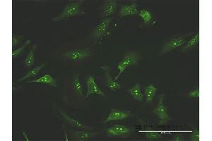 Immunofluorescence of purified MaxPab antibody to FNTA on HeLa cell.