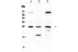Western blot analysis of TIMP4 using anti- TIMP4 antibody . (TIMP4 抗体  (AA 174-224))