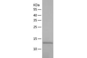 Western Blotting (WB) image for CCCTC-Binding Factor (Zinc Finger Protein) (CTCF) (AA 1-154) protein (His tag) (ABIN7122187) (CTCF Protein (AA 1-154) (His tag))