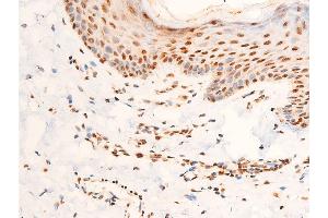 ABIN6267306 at 1/100 staining human skin tissue sections by IHC-P. (C-JUN 抗体  (pThr91))