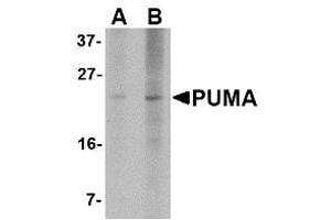 Image no. 1 for anti-BCL2 Binding Component 3 (BBC3) (AA 76-170) antibody (ABIN1491660) (PUMA 抗体  (AA 76-170))
