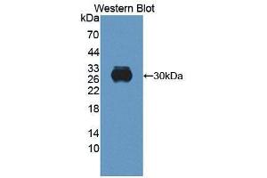 Western blot analysis of the recombinant protein. (Retbindin 抗体  (AA 32-247))