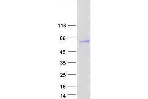 Validation with Western Blot (HERPUD1 Protein (Transcript Variant 1) (Myc-DYKDDDDK Tag))