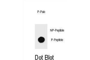 Dot blot analysis of Phospho-KIT- Antibody Phospho-specific Pab (ABIN1539724 and ABIN2839882) on nitrocellulose membrane. (KIT 抗体  (pThr274))