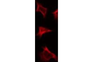 ABIN6275840 staining HepG2 by IF/ICC. (DDR1 抗体  (Internal Region))