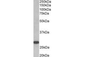 Image no. 1 for anti-Thyroid Stimulating Hormone Receptor (TSHR) (AA 101-115), (Extracellular Domain) antibody (ABIN1104855) (TSH receptor 抗体  (Extracellular Domain))