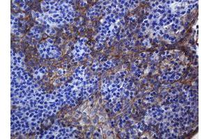 Image no. 2 for anti-Cadherin 1, Type 1, E-Cadherin (Epithelial) (CDH1) antibody (ABIN1497941) (E-cadherin 抗体)