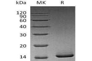 Western Blotting (WB) image for Colony Stimulating Factor 2 (Granulocyte-Macrophage) (CSF2) (Active) protein (ABIN7320537) (GM-CSF 蛋白)