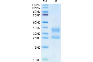 SDS-PAGE (SDS) image for CD3D & CD3E (AA 23-120) protein (His tag,Biotin) (ABIN7274137)
