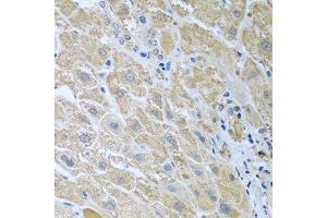 Immunohistochemistry of paraffin-embedded human liver using WDR48 antibody. (WDR48 抗体  (AA 450-677))