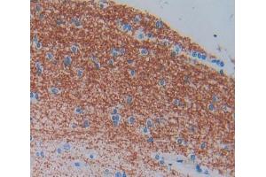 Used in DAB staining on fromalin fixed paraffin- embedded brain tissue (ELMO2 抗体  (AA 501-720))
