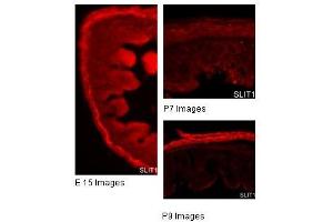 SLIT1 antibody used at a concentration of 2 and 10 ug/ml to detect gut tissue. (SLIT1 抗体)