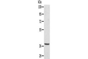 Gel: 8 % SDS-PAGE, Lysate: 40 μg, Lane: Hepg2 cells, Primary antibody: ABIN7192738(TBC1D21 Antibody) at dilution 1/300, Secondary antibody: Goat anti rabbit IgG at 1/8000 dilution, Exposure time: 10 seconds (TBC1D21 抗体)