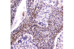 IHC analysis of Dynamin 1 using anti-Dynamin 1 antibody . (Dynamin 1 抗体  (AA 616-667))