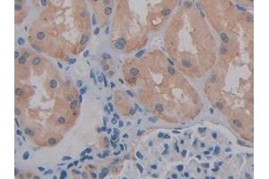 Immunohistochemistry (IHC) image for anti-Basigin (Ok Blood Group) (BSG) (AA 79-280) antibody (ABIN7433759)