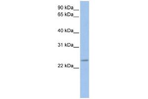 FKBP3 antibody used at 1 ug/ml to detect target protein. (FKBP3 抗体  (C-Term))