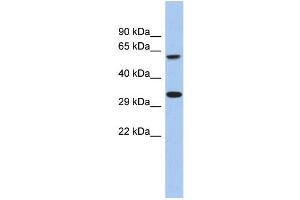 WB Suggested Anti-FAM26A Antibody Titration: 0. (CALHM3 抗体  (C-Term))