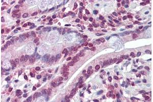 Human Small Intestine: Formalin-Fixed, Paraffin-Embedded (FFPE) (ABCC8 抗体  (N-Term))