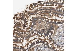 Immunohistochemical staining of human colon with WDR31 polyclonal antibody  strong cytoplasmic positivity in glandular cells at 1:200-1:500 dilution. (WDR31 抗体)