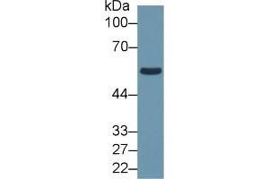 Detection of ALDH1B1 in Human HepG2 cell lysate using Polyclonal Antibody to Aldehyde Dehydrogenase 1 Family, Member B1 (ALDH1B1) (ALDH1B1 抗体  (AA 18-517))