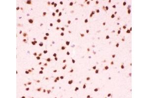 Immunohistochemistry (IHC) image for anti-Activating Transcription Factor 2 (ATF2) (AA 93-450) antibody (ABIN3029845)