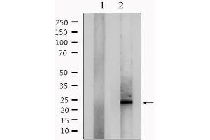 Western blot analysis of extracts from mouse lung, using RANBP1 Antibody. (RANBP1 抗体  (N-Term))