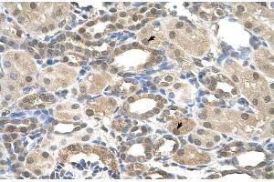 Immunohistochemistry (IHC) image for anti-Presenilin 2 (Alzheimer Disease 4) (PSEN2) (N-Term) antibody (ABIN2781802)