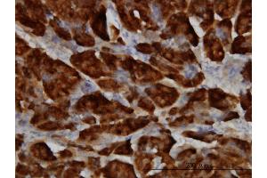 Immunohistochemistry (IHC) image for anti-serine Peptidase Inhibitor, Kazal Type 1 (SPINK1) (AA 24-79) antibody (ABIN562978)