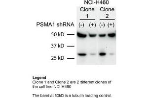Sample Type: Human non-small cell lung cancer (NCI-460)Primary Dilution: 1:2000Secondary Dilution: 1:300050kDa band is a tubulin loading control band PSMA1 is strongly supported by BioGPS gene expression data to be expressed in Human NCI460 cells