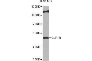 Western blot analysis of extracts of U-87MG cells, using GLP1R antibody (ABIN6292480) at 1:1000 dilution. (GLP1R 抗体)