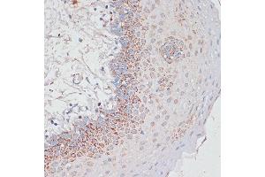 Immunohistochemistry of paraffin-embedded Human tonsil using Desmoplakin antibody (ABIN6134106, ABIN6139838, ABIN6139840 and ABIN6223548) at dilution of 1:100 (40x lens). (Desmoplakin 抗体  (AA 1-100))